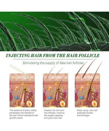 120ML Pure Rosemary Hair Growth Oil - Nourishing Scalp & Strengthening Essential Oil - Buy Online on GoSupps.com