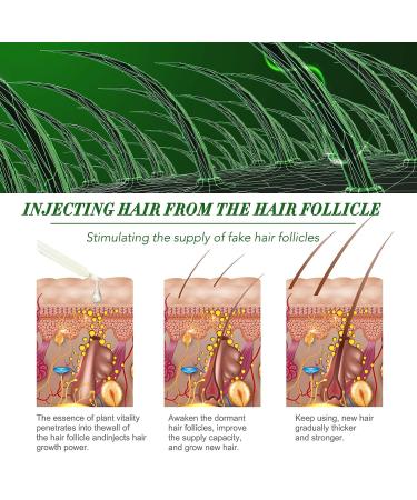 Rosemary Oil 120ML - 100% Pure for Hair Growth & Skin Care | Nourishes & Strengthens Hair, Stimulates Growth | Eyelashes & Eyebrows Serum - Buy Online on GoSupps.com