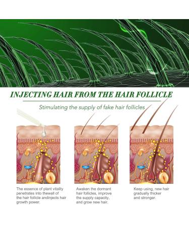 Buy 60ml Rosemary Oil for Hair Growth & Scalp Care | Essential Natural Oil for Eyebrows & Eyelashes - Prevent Hair Loss - Buy Online on GoSupps.com
