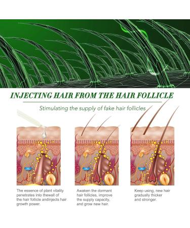 100% Natural Rosemary Oil for Hair Growth - 120ml | Scalp Massage & Aromatherapy - Buy Online on GoSupps.com