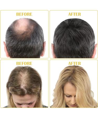 Hair Growth Oil Serum for Men & Women - Prevent Hair Loss, Enhance Natural Growth, Repair Damaged Scalp - 60ml - Buy Online on GoSupps.com
