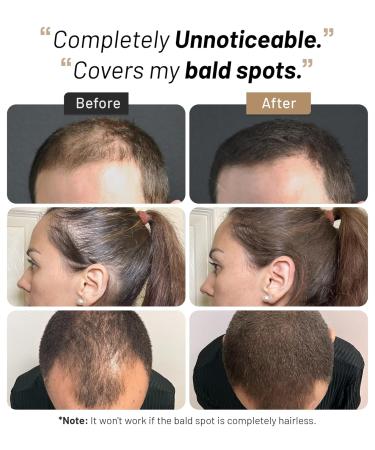 Keratin Hair Fibers for Men & Women - Thicker Hair Solution Fill Fine & Thinning Hair (Dark Brown 15g - Buy Online on GoSupps.com