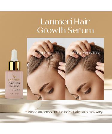Lanmeri Vegan Hair Growth Serum - Natural Treatment for Hair Loss - Fuller, Thicker Hair in 90 Days - For Women & Men - Buy Online on GoSupps.com