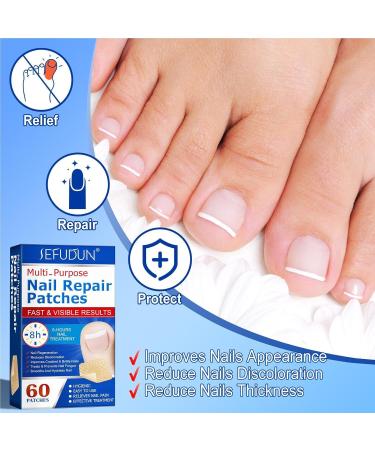 Nail Repair Plaster Nail Repair Kit For Broken Natural Nails Extra Strength Treatments For Damaged Nails Non-irritating Breathable Toenail Correction Treatments - Buy Online on GoSupps.com