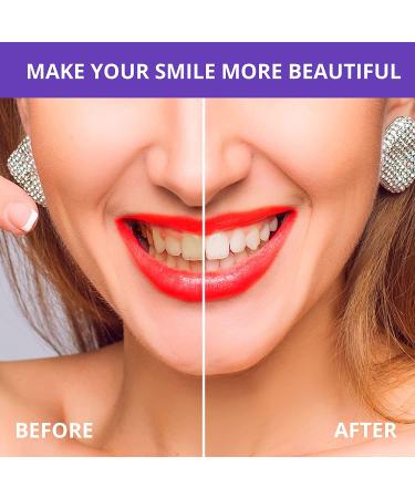 ROSETRA V34 Purple Teeth Whitening Colour Corrector - Tooth Stain Removal Booster - Toothpaste for Colour Correcting Teeth (1 Fl Oz) - Buy Online on GoSupps.com