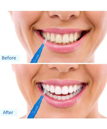 100 Pcs Interdental Brush Flosser for Dental Hygiene - Red and Blue Toothpick Cleaners - Buy Online on GoSupps.com