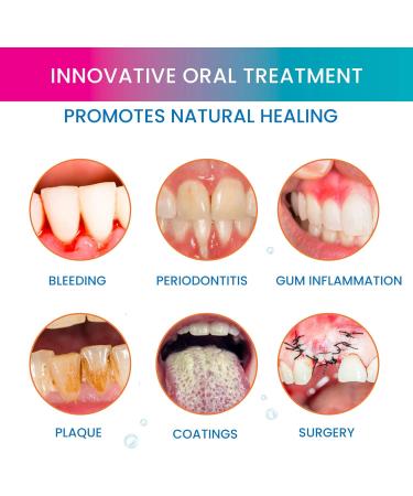 OROXID Forte Mouthwash 250 ml - Intensive Oral Care & Periodontitis Treatment | Buy Online for International Shipping - Buy Online on GoSupps.com