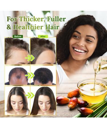 Dr. Sebi Batana Oil - 100% Natural & Organic Hair Growth Oil from Honduras | Enhance Thickness & Prevent Hair Loss for Men & Women - Buy Online on GoSupps.com