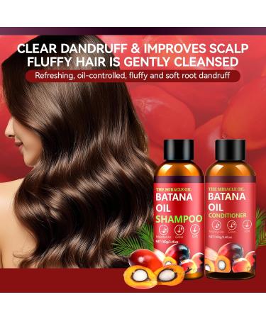 Batana l Shampoo und Conditioner Set Batana Haar Shampoo Set f r Haarwachstum Shampoo Conditioner f r Wiederherstellung besch digtes Haar d nnes Haar beseitigt Spliss 0.5 g (Lot de 2) - Buy Online on GoSupps.com