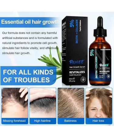 Waymaytecy 60 ml hair growth serum stimulates hair growth stimulates hair growth strengthens the scalp hair care for men and women - Buy Online on GoSupps.com