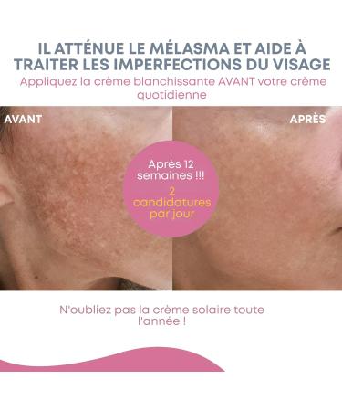  Gynebal GYNEBAL Depigmenting Cream with Niacinamide Lightening Anti-Spot and Gentle Intimate and Sensitive Areas Underarms Groin Elbows Knees Hands and Melasma 30 ml - Buy Online on GoSupps.com