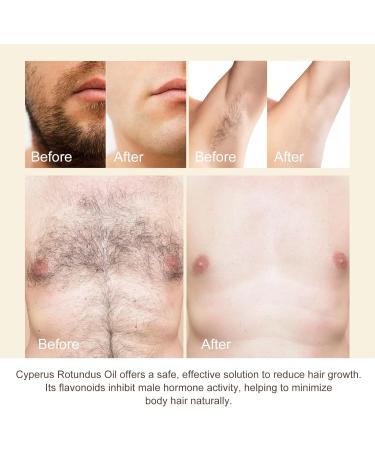  Generisch Cyperus Rotundus Hair Removal Oil 100% Pure Natural Hair for Body and Face for Women Reduces Unwanted Hair Growth After Sha - Buy Online on GoSupps.com