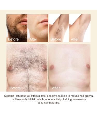 Cyperus Rotundus Oil Natural Nut Grass Cyprus Oil for Reducing Body Hair Growth Smooth Skin & Hairs Removal Moisturizing & Soothing for All Skin Types Hair Removal Solution - 2.02 oz (1) - Buy Online on GoSupps.com