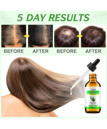 Pure Rosemary Oil for Hair Growth - Natural Scalp Nourishment & Hair Loss Reduction - Buy Online on GoSupps.com