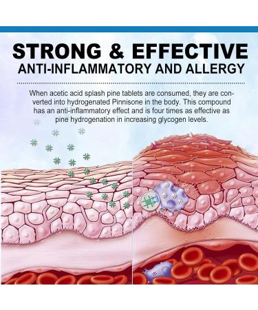 Itchy Dog Skin Relief Anti Itch and Immunity Treats for Dogs Anti Itch for Dogs Dog Allergy Relief w/Omega 3 + Pumpkin + Enzymes Seasonal Allergies Hot Spots Peking Duck Flavor 150 Treats - Buy Online on GoSupps.com