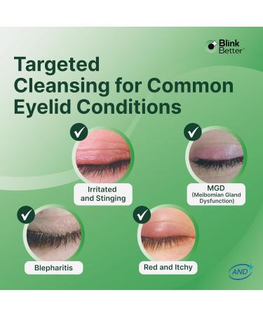 BetterLids Eyelid Cleansing Gel Gentle Centella & Tea Tree Extract Cleanser Refreshes & Cleanses for Daily Eyelid Care Preservative-Free 1.06 oz - Buy Online on GoSupps.com