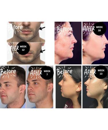 Gumbells 12XHard Jawline & facial fitness xylitol chewing gum (2MONTH-PACK) Enhance Define & strengthen your Jaw Jawline Face Mouth & Jawrz Chios style Workout exerciser trainer GUM 4 Men & Women - Buy Online on GoSupps.com