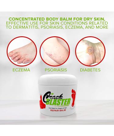 Crack Blaster Repair Balm - Intense Treatment for Dry Cracked Heels, Hands, Fingers, and Elbows - Fragrance-Free Skin Care - Buy Online on GoSupps.com