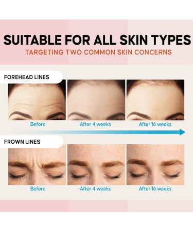 Forehead Wrinkle Patches - Anti-Wrinkle Treatment with Hydrolyzed Collagen & Vitamin E | 8pcs for Smooth Youthful Skin - Buy Online on GoSupps.com