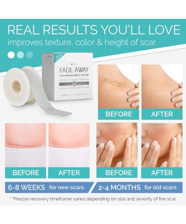 Fade Away Scars - Original Silicone Scar Sheeting Roll | Custom Size Medical Grade Scar Sheets & Strips for Effective Scar Treatment - Buy Online on GoSupps.com