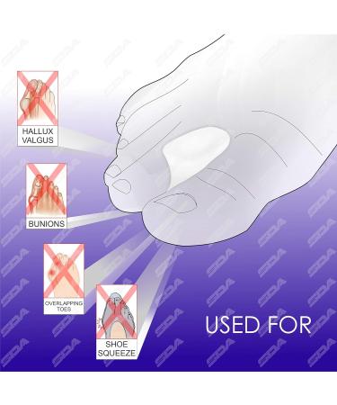 Silicone Toe Spreaders Bunion Gel Toe Spacers Separators - 4 PCS - Bunion Correctors Gel Toe Seperators Orthotics for Bunion Pain Relief Overlapping Toes - Buy Online on GoSupps.com