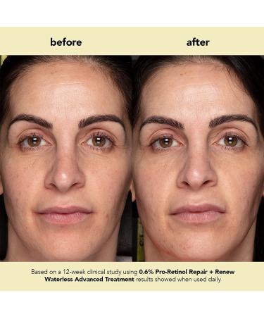 boscia 0.6% Pro-Retinol Repair + Renew Waterless Advanced Treatment - Vegan Cruelty-Free Natural Skin Care - For Fine Lines & Wrinkles - 1 fl oz 1 Fl Oz (Pack of 1) Clear - Buy Online on GoSupps.com