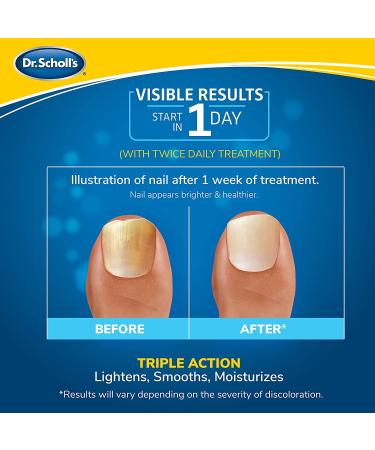 Dr. Scholl's Fungal Nail Treatment Revitalizer with LED Light Therapy - 10ml - Buy Online on GoSupps.com