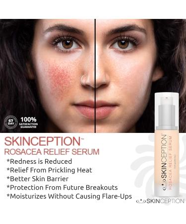 Skinception Rosacea Relief Serum 1 oz - Pack of 2 Bottles - Buy Online on GoSupps.com