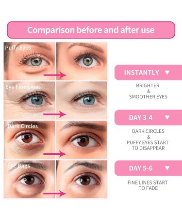 BREYLEE Pink Rose Eye Mask 60 Pcs - Under Eye Masks for Puffy Eyes, Dark Circles, and Wrinkles - Buy Online on GoSupps.com