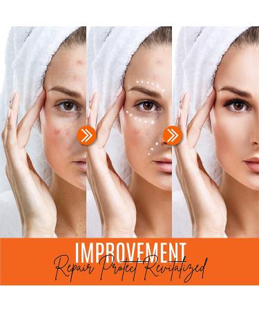 Dermaxgen 30% Vitamin C Serum with Hyaluronic Acid & Vitamin E - Anti Aging, Anti Wrinkle, Skin Rejuvenator - 2 FL OZ - Buy Online on GoSupps.com