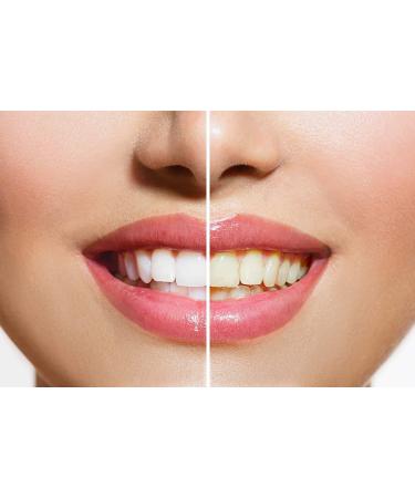Organic Teeth Whitening | Natural Tooth Whitener for Bright White Teeth | 30g - Buy Online on GoSupps.com