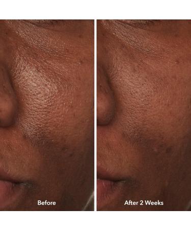 Beekman 1802 Potato Peel - 1.69 fl oz - Fragrance Free - Rapid Resurfacing Milk Facial - At-Home Peel - Visibly Reduces Appearance of Fine Lines & Dark Spots - Good for Sensitive Skin - Cruelty Free - Buy Online on GoSupps.com