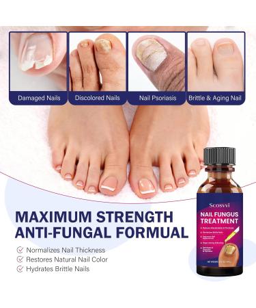 Extra Strength Toenail Fungus Treatment - Antifungal Solution for Nail & Athlete's Foot Care - Buy Online on GoSupps.com