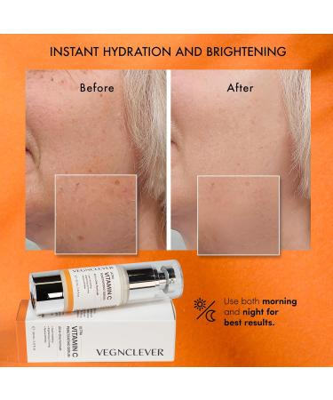 Vegnclever Super Vitamin C Serum - Anti-Aging Moisturizing Face Serum with Niacinamide & Collagen - Buy 2 Pack for Optimal Skin Health - Buy Online on GoSupps.com