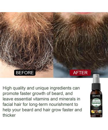 Fulenyi Beard Growth Kit - 30ml Beard Care Set for Men | Derma Roller Serum Oil & Balm - International Shipping Available - Buy Online on GoSupps.com