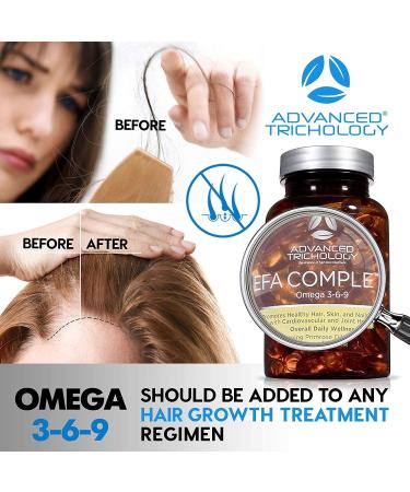 EFA Complete High Potency Omega 3 6 9 Flax, Fish, Borage & Evening Primrose Oil 800mg - 90ct | 3rd Party Tested, High GLA & 369 Omegas - Buy Online on GoSupps.com