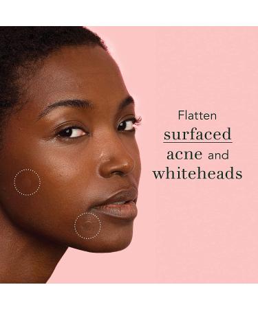 Rael Acne Pimple Healing Patch - Invisible Hydrocolloid Spot Treatment (96 Count, 10mm & 12mm) - Buy Online on GoSupps.com