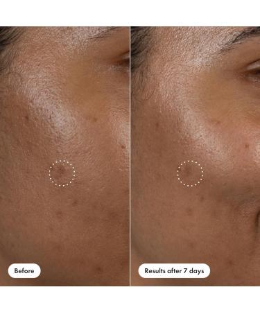 Hero Cosmetics Dark Spot Correct Spot-Fading 15% Vitamin C plus Hyaluronic Acid Serum. Improves the Look of Post Blemish Marks in 7 Days. Twist Applicator and Rollerball Tip for Easy Application. 10mL - Buy Online on GoSupps.com