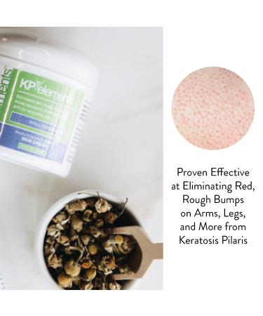 KP Elements Keratosis Pilaris Lotion (4 fl oz) - Natural Treatment for KP | Vegan & Exfoliating AHA Moisturizer | Made in USA | 4 fl oz - Buy Online on GoSupps.com