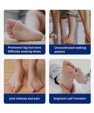 DAPIN Bunion Corrector 6 Pack - Toe Straightener, Separator & Protector Set for Bunion Relief - Buy Online on GoSupps.com