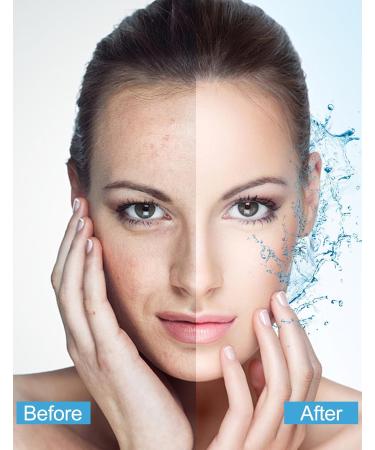 Jutqut Skin Face Sheet Masks Face Mask Korean Skincare Hydrating Nourishing Facial Mask Fruit Face Masks Moisturising Face Care Set Hyaluronic Acid Replumping Tissue Mask Biodance Collagen Mask - Buy Online on GoSupps.com