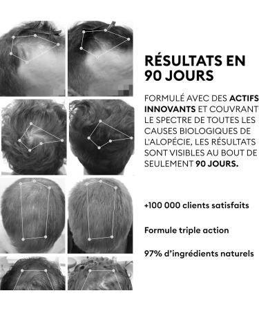 OMA & ME 3 in 1 Hair Regrowth Protocol - Hair Growth and Anti Hair Loss Treatment Serum - Growth and Hair Loss Reduction - Made in France - 12 Vials of 6ml (1 month treatment) - Buy Online on GoSupps.com