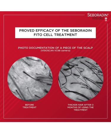 Seboradin Hair Mask for Hair Growth | Accelerate Hair Care & Thickening | Fito Cell Formula - Buy Online on GoSupps.com