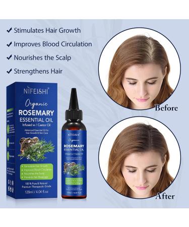 Rosemary Essential Oil for Hair Growth - 120ml Pure Organic Infusion with Castor Oil | Scalp Massage & Body Care Improves Circulation & Reduces Hair Loss - Buy Online on GoSupps.com