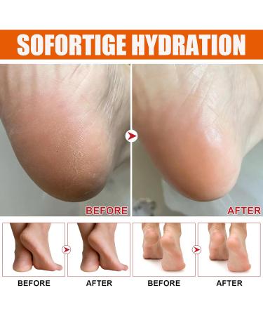 MrCuvaryas Urea Creme Foot Care Cream Urea Foot Cream Very dry feet for dry cracked feet heels elbows - Buy Online on GoSupps.com