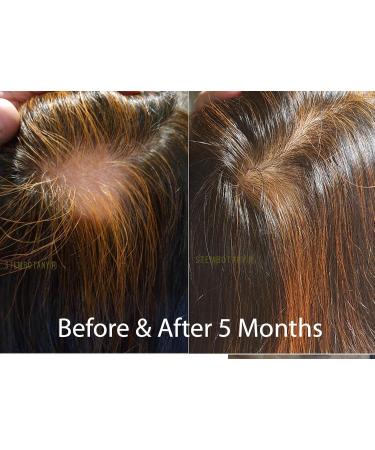 GHK-cu Copper Peptide Hair Regrowth Shampoo for Men & Women - Boost Hair Growth Nourish & Revitalize Shop Internationally - Buy Online on GoSupps.com