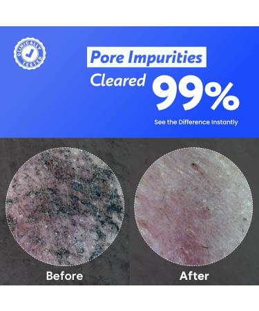 Coconut Jelly Pudding Cleanser | Deep Pore Cleansing & Gentle Exfoliation with Jelly-to-Foam Texture | Hydrating Face Wash with Panthenol Ceramide & Peptides (100ml) 3.38 Fl Oz (Pack of 1) - Buy Online on GoSupps.com