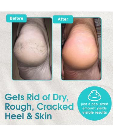 Daily Exfoliating Foot Scrub - Feet Care Deodorizer for Rough Heels & Cracked Skin - Buy Online on GoSupps.com