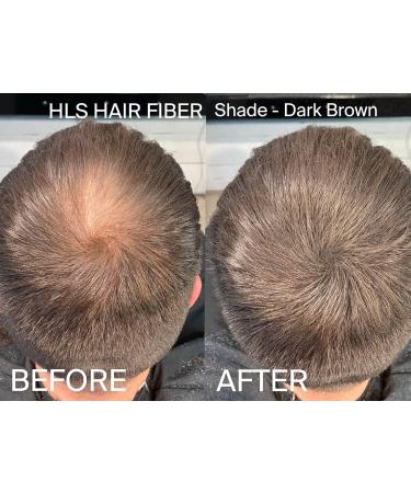 HLS Hair Fibers Dark Brown | Hair Fiber Lightening Powder 25g Bottle | Instantly Increases Thickness with Concealer for Women and Men - Buy Online on GoSupps.com