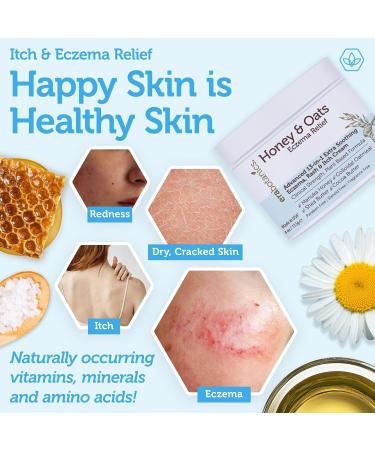 Eczema Cream with Manuka Honey & Colloidal Oatmeal Extra Strength Anti Itch Cream for Dry Sensitive Skin Dermatitis & Itchy Skin Relief Moisturizer for Adults & Kids Steroid Free Face & Body Use - Buy Online on GoSupps.com